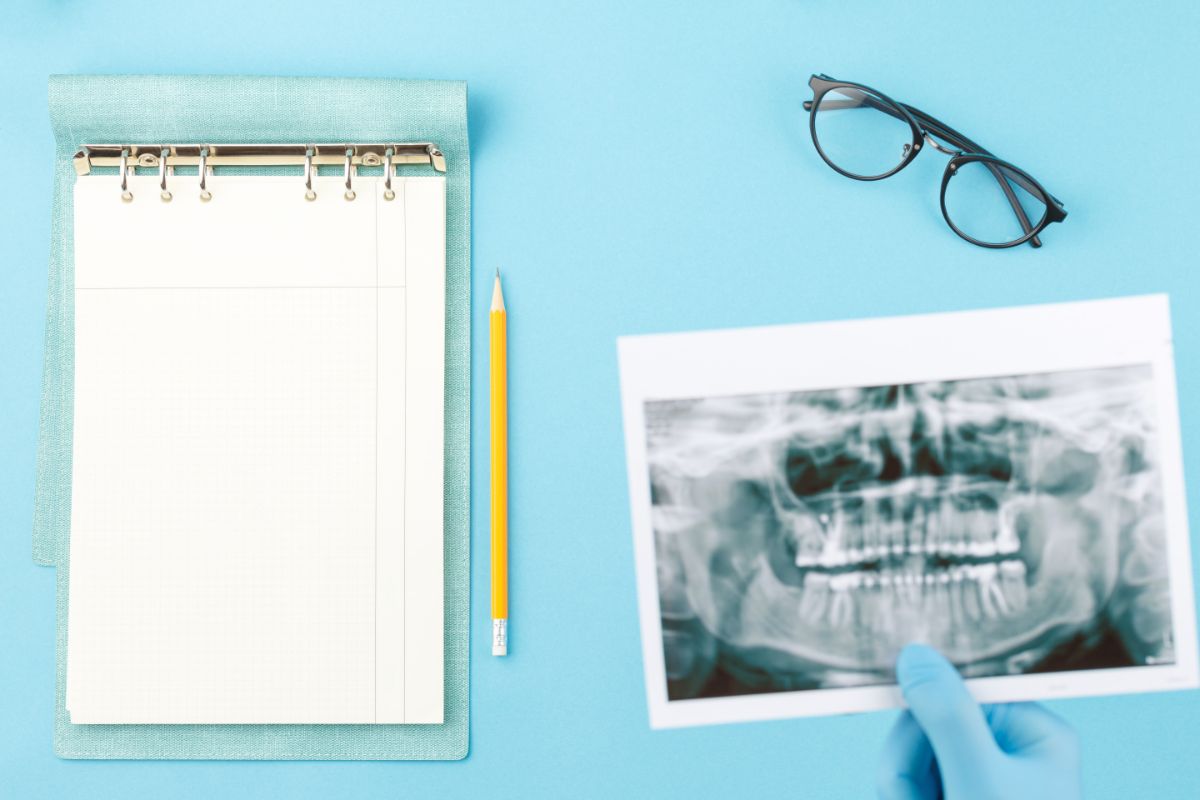 Tips for Recovering from a Bone Graft for Dental Implants